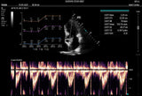 Mindray TE X Portable Ultrasound System