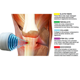 Pulse Wave™: Revolutionizing Shockwave Therapy