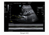 Mindray TE7 Ultrasound System Crystal Series 2.0