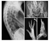 Varex Imaging - Lumen 4336W DR Systems (14×17″)