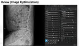 H&abyz HnX-P1OPIX Handheld Radiography System