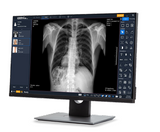 ExamVue Apex 10x12" Wireless Detector