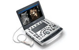 Mindray M8 Elite Diagnostic Ultrasound System