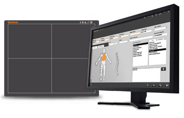 Carestream Focus 35C Detector - Digital X-ray System