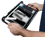 Radmedix Acuity 10 x 12 Wireless Digital X-ray Gadox Panel