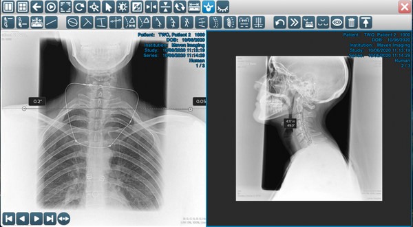 Patient Image Chiropractic Cloud PACS (Subscription Fee)