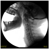 SkanRay SkanC High Frequency Mobile C-Arm Package
