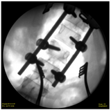 SkanRay SkanC High Frequency Mobile C-Arm Package