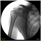 SkanRay SkanC High Frequency Mobile C-Arm Package