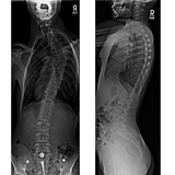 Fuji FDR D-EVO GL - Long length Digital X-ray
