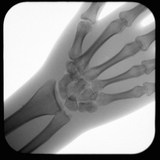 Support Stand with Tablet Arm Smart-C Arm