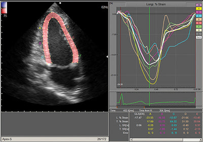 Fujifilm Ultrasound - Cardiovascular Ultrasound Arietta 650DI