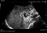 Fujifilm Ultrasound - Arietta 750DI General Imaging