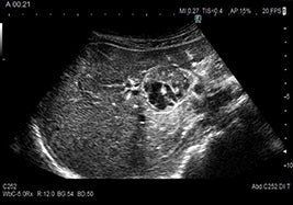 Fujifilm Ultrasound - Arietta 750DI General Imaging