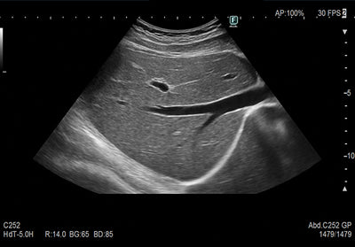 Fujifilm Ultrasound - Arietta 750DI General Imaging
