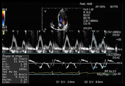 Fujifilm Ultrasound - Arietta 750DI General Imaging