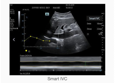 Mindray TE7 Ultrasound System Crystal Series 2.0
