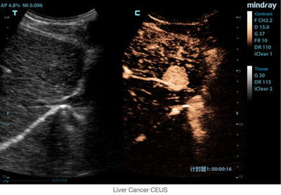 Mindray Ruby Edition M9 Ultrasound System