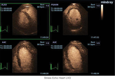 Mindray Ruby Edition M9 Ultrasound System