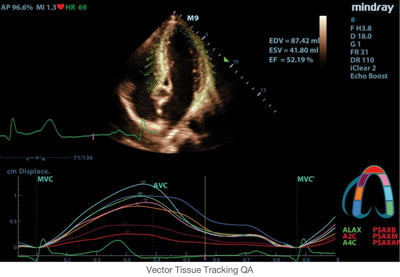 Mindray Ruby Edition M9 Ultrasound System