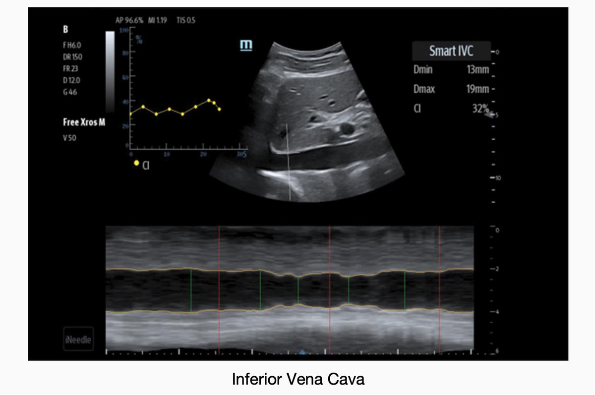 Me8 Mindray ME8 Laptop Ultrasound Machine – MavenImaging