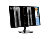 Medlink CDR - Advanced Digital Radiography for Chiropractic Care