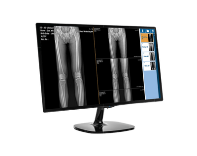 Medlink CDR - Advanced Digital Radiography for Chiropractic Care