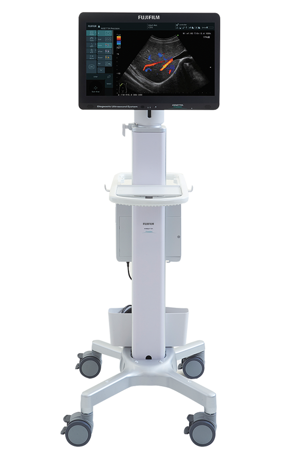 Fujifilm Ultrasound  Surgery Oncology Precision