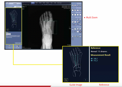 Rayance Podiatry x-ray system with 10x12 Wireless Panel Package