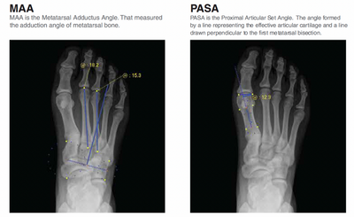 Rayance Podiatry x-ray system with 10x12 Wireless Panel Package