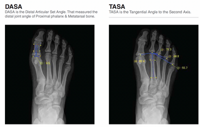 Rayance Podiatry x-ray system with 10x12 Wireless Panel Package