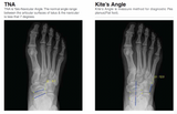 Rayance Podiatry x-ray system with 10x12 Wireless Panel Package