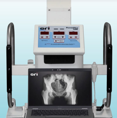 Source Ray PowerMax 1260 Portable X-ray System