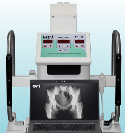 Source Ray SR-130 Portable X-Ray System