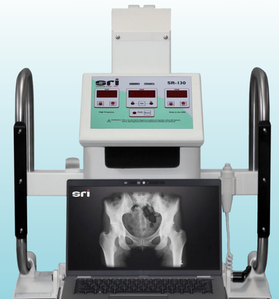 Source Ray SR-130 Portable X-ray w/ Digital Upgrade Kit