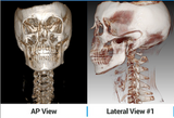 NEW Chiropractic CBCT - CHIRO-CBCT PAPAYA 3D PREMIUM