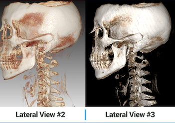 NEW Chiropractic CBCT - CHIRO-CBCT PAPAYA 3D PREMIUM