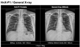 H&abyz HnX-P1OPIX Handheld Radiography System