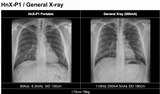H&abyz HnX-P1OPIX Handheld Radiography System