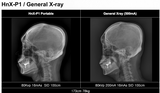 H&abyz HnX-P1OPIX Handheld Radiography System