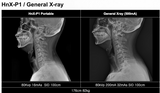 H&abyz HnX-P1OPIX Handheld Radiography System