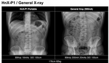 H&abyz HnX-P1OPIX Handheld Radiography System