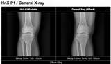 H&abyz HnX-P1OPIX Handheld Radiography System