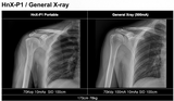 H&abyz HnX-P1OPIX Handheld Radiography System