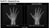 H&abyz HnX-P1OPIX Handheld Radiography System