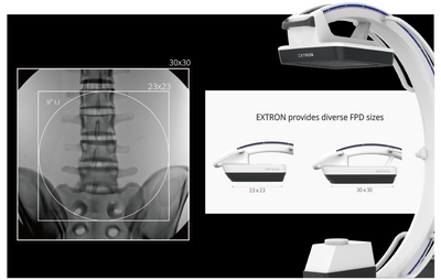 EXTRON 5 Mobile C-arm