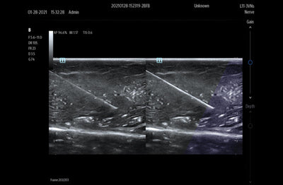 Mindray TE7 Max Point of Care Ultrasound