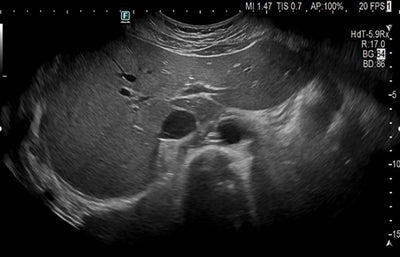 Fujifilm Ultrasound - Arietta 750DI General Imaging