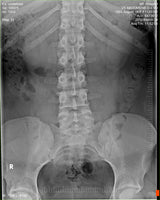 Fujifilm -  D-EVO Suite (OTCx & FSx)