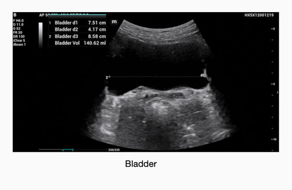 Me8 Mindray ME8 Laptop Ultrasound Machine – MavenImaging